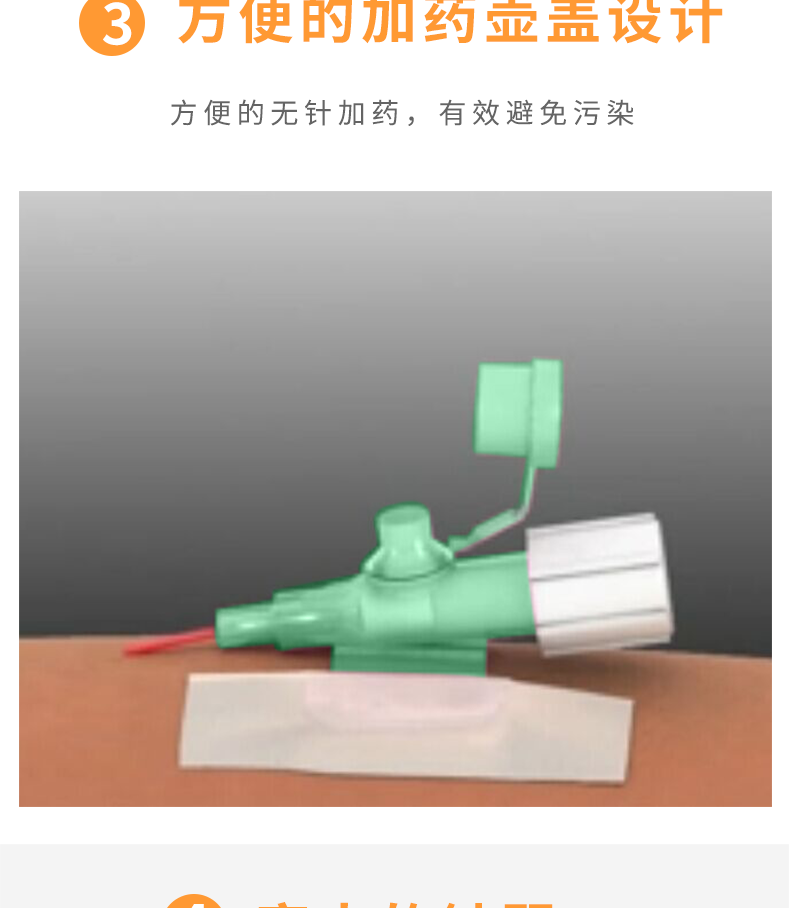 沃素安18G动静脉留置针