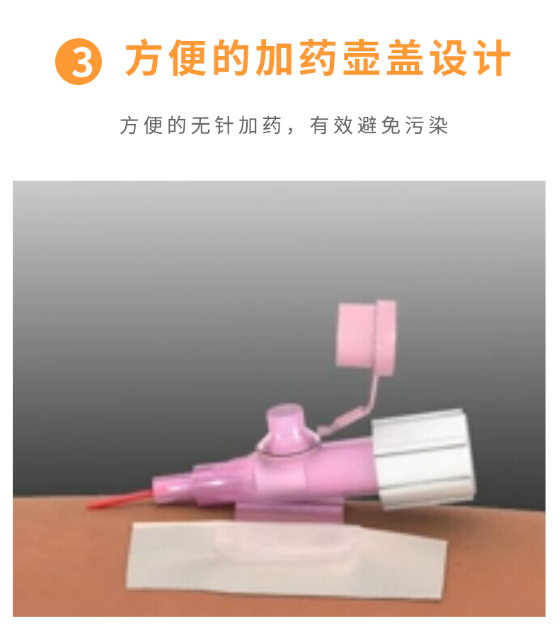 沃素安20G动静脉留置针