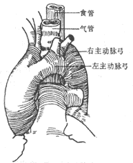 双主动脉弓:左主动脉弓远段较细且动脉韧带位于左侧者,进胸后在迷走