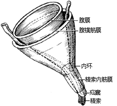 一般腹股沟斜疝修复术