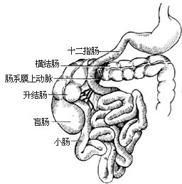 ⑴中肠反旋转,十二指肠和肠系膜上血管压迫横结肠