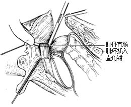 白毛女插曲全部歌曲谱(2)